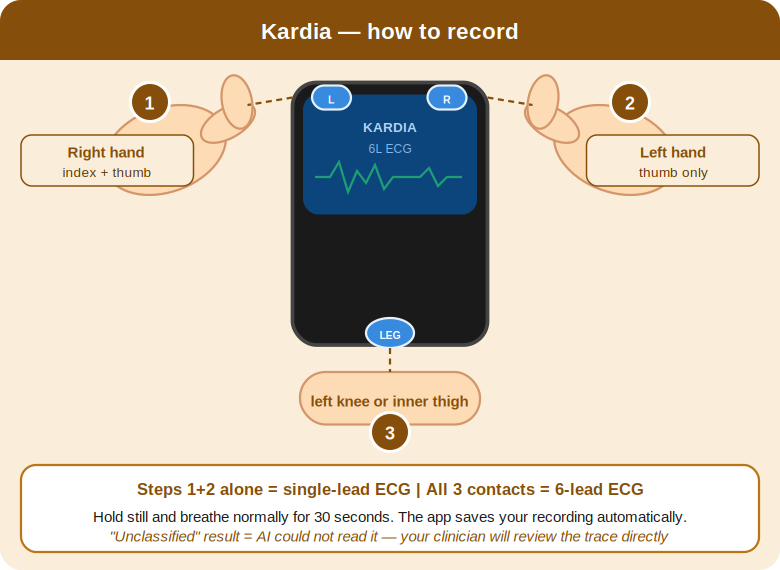 Diagram showing how to record with Kardia: right hand index and thumb on top electrodes, left thumb on bottom, optionally rest on left knee for 6-lead ECG.